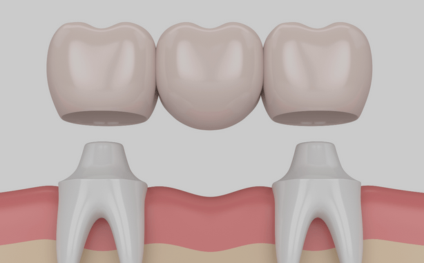 Treatment - Charlbury Dental Practice