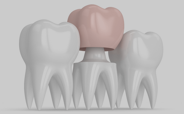Treatment - Charlbury Dental Practice